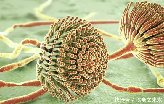 家中常见的1种“水果”,或是“伤肝利器”,告知家人尽量少吃