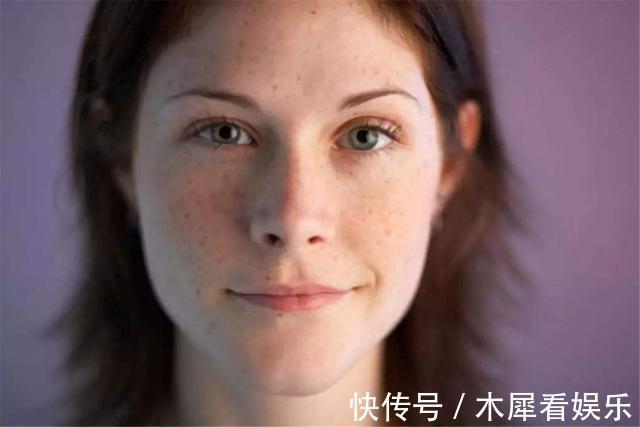 张医师|女人长老年斑，先别慌，牢记4个方法，脸上变得干净又美丽