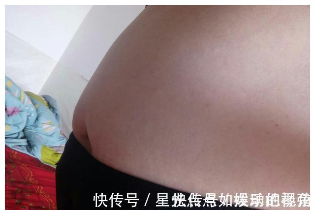 孕妇|女人如果多次剖腹产,肚子会变成什么样?看完觉得“头皮发麻”