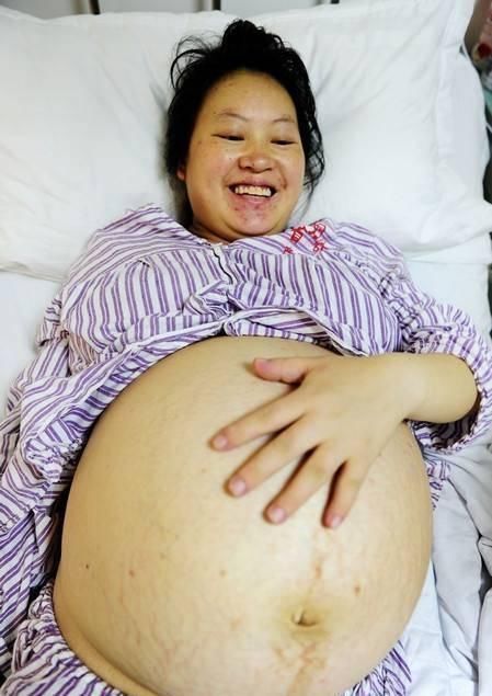 产妇|28岁产妇生下四胞胎,丈夫知道性别后傻了,回家赶紧卖方卖车