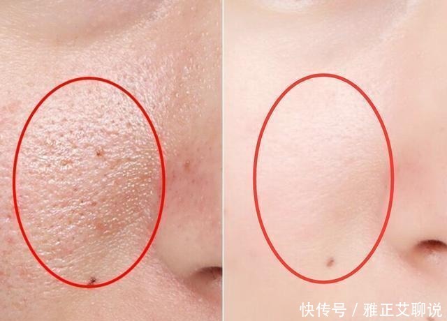 使用爽肤水时倒手上就开始拍?医生都哭笑不得:果然是人傻钱多!