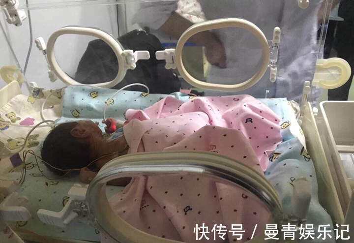 饮水量|羊水质量的好坏,决定胎儿是否健康,孕期要避免出现这些行为