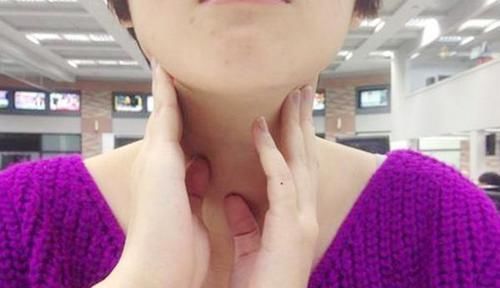 甲状腺有结节,不能吃海鲜少吃四类食物,结节或慢慢消下去