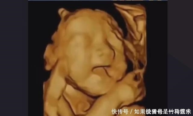 胎儿|怀孕晚期，如何判断“要生了”？3个方法要牢记，别把孩子生家里