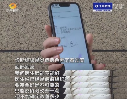 修复 女子花5000元祛斑后懊恼被“毁容”,工作人员:正常现象