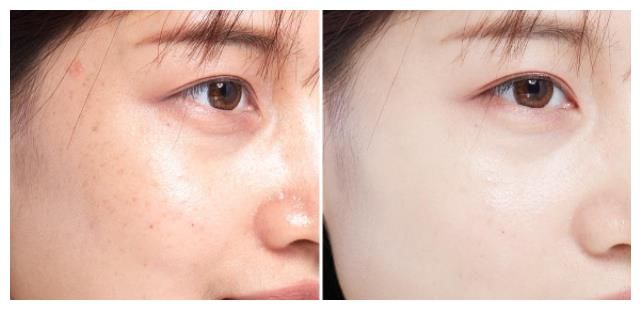 原来我们真的不会洗脸！难怪皮肤差，这3个“误区”要注意