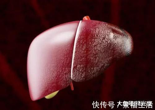 嗜酒成瘾|嗜酒成瘾的人多有这4个表现，如果你也有，或有3件“麻烦事”