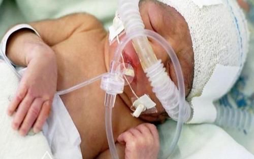 脐带|新手妈妈一时手欠,宝宝患上“败血症”进ICU,医生怒斥妈妈无知