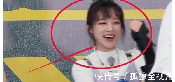 牙疼|被大球砸到牙疼,宋雨琦却慌张抚摸下巴,看清下巴形状我明白了