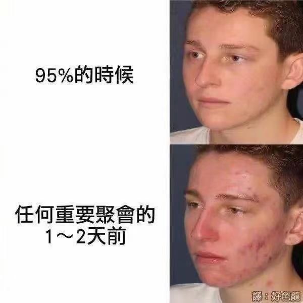 从未护理过的手和身体,比重金呵护的脸还白嫩?科学拯救你的脸!