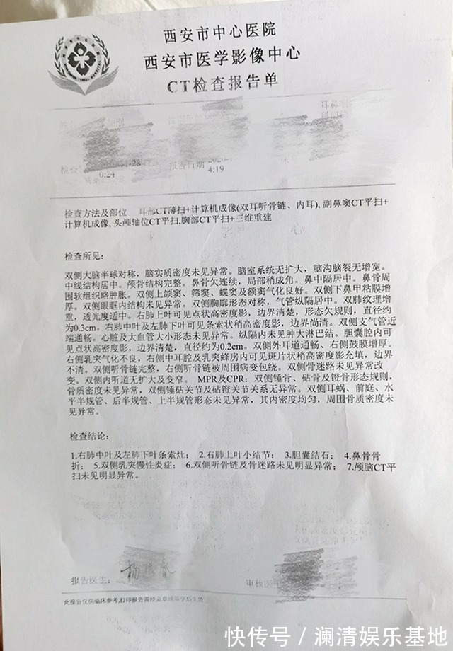鼻骨骨折复位手术过程 鼻骨骨折复位手术过程