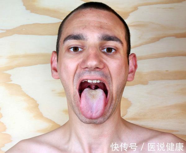 脾运化|脾虚时,身体或出现4种情况,若你有,要注意该健脾了