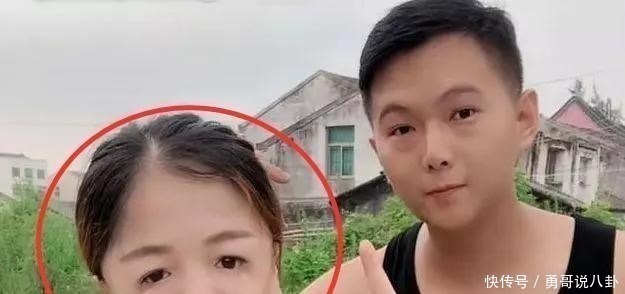 怀孕|“鸟脸”妈妈不顾劝阻生二胎,二宝没躲过遗传,是任性还是母爱