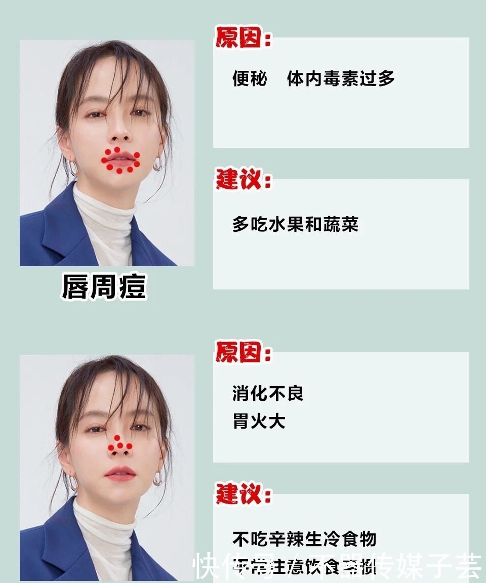 睡眠时间|二十几了还长痘?别再用烂脸的招数了,几招教你养出水润肤质