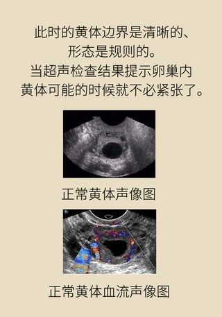 诱因|这种腹痛常被误任宫外孕，背后诱因要牢记