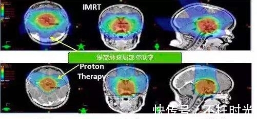 他把头伸进了粒子加速器,直接被接近光速的