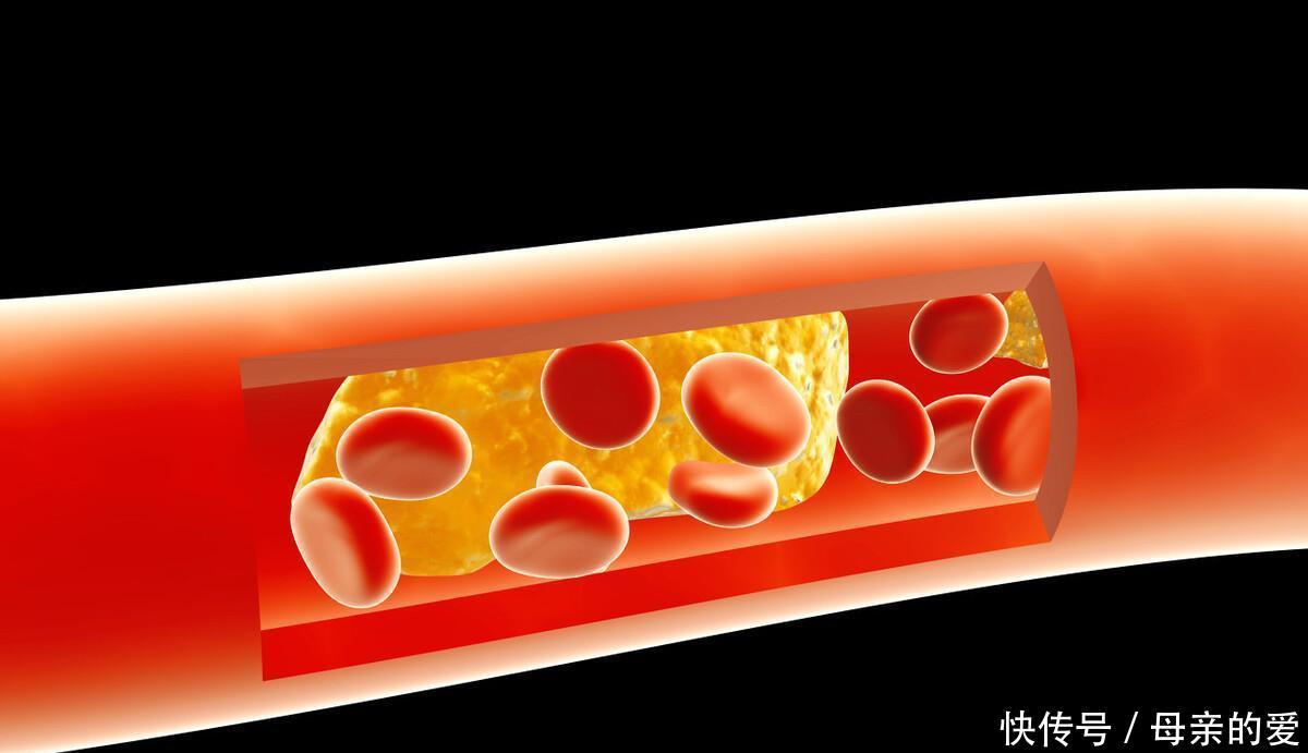 蹲下后突然起身眼前一黑,这是怎么回事?不一定是贫血,早作了解