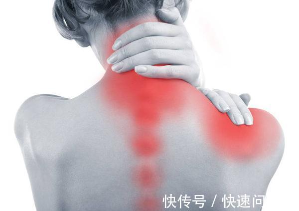 手术治疗|脖子经常咔咔响,是颈椎病吗?这3种情况也会引起颈椎咔咔响