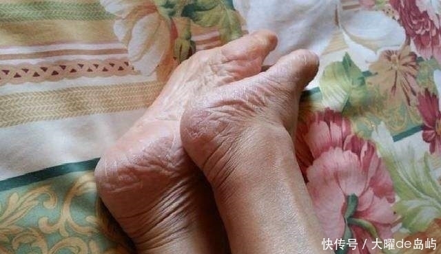 “脚后跟干裂”是什么原因导致的？你遇到过这种情况吗？别忽视！
