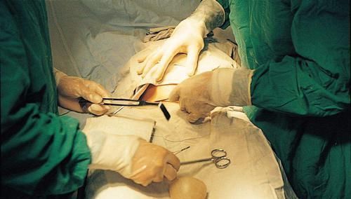 子宫|切开子宫拿出胎儿,剖腹产听着容易,手术时却并不简单,伟大!