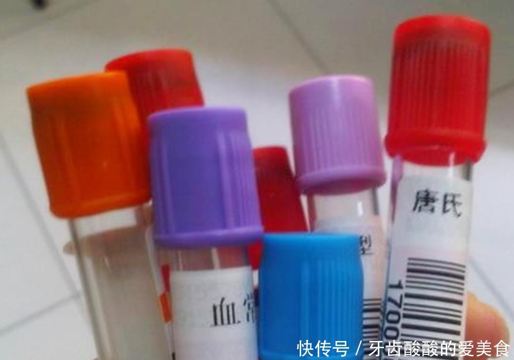 妈妈|一个孕期下来,孕妇要抽多少管“血”?过来人:血管都“干瘪”了