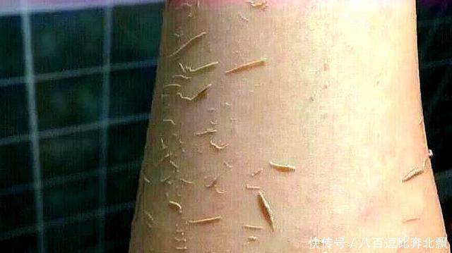 洗澡搓下的“黑泥”是什么？拿显微镜放大200倍，看完让人大开眼界