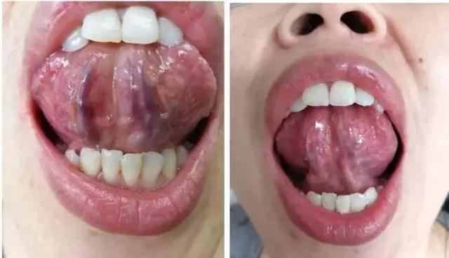 舌诊|中医医生总看舌头都在看什么九种体质+珍贵的舌诊图谱