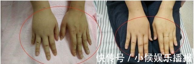 脚部|怀孕后,不止肚子变大,某些部位也会“疯长”,多数孕妇都逃不过