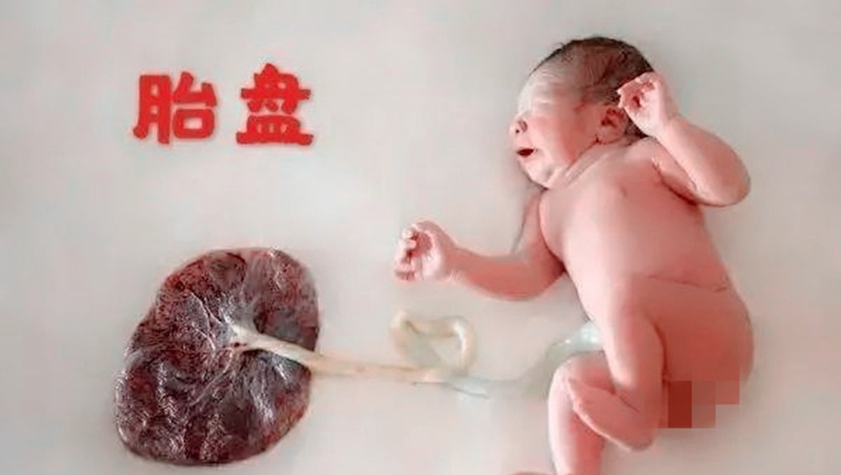 婆婆|生完宝宝后,你的胎盘“埋了”还是“吃掉”?做法不同结果大不同