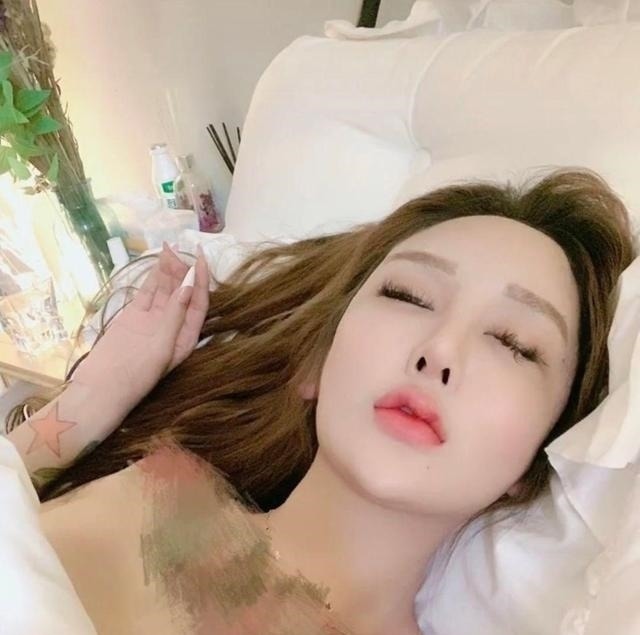 整形手术 8年的整形手术花费了100多万,光额头就打了200多支玻尿酸