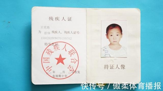 干活|女子意外怀孕后不顾反对生下双胞胎,医生看后断言:活不过18岁