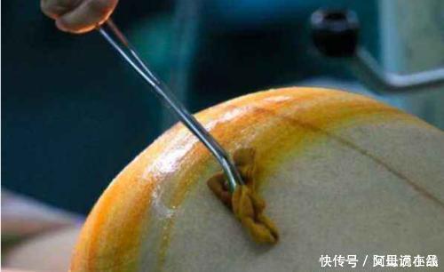 顺产|顺产妈妈分娩后腹部还会有个鼓鼓的硬块是怎么回事