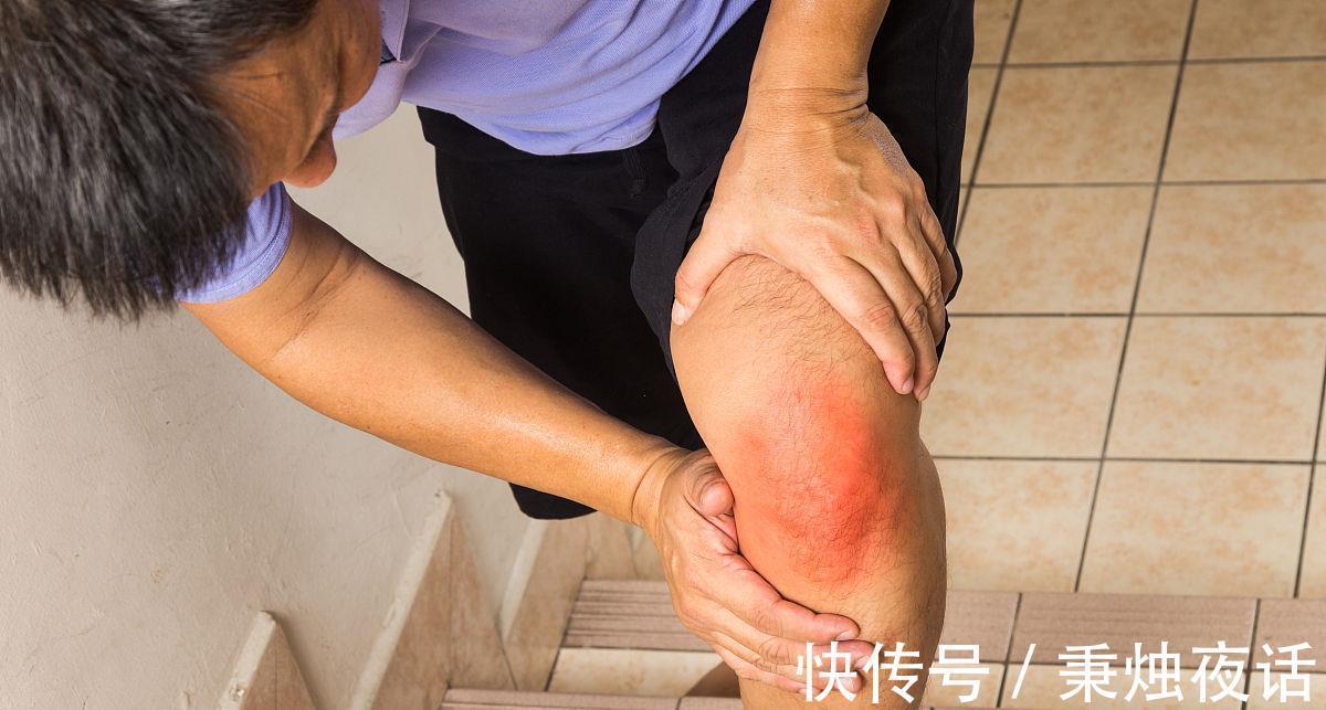 喝啤酒|三伏天已至,尽早停止这些“高嘌呤”举动,防止尿酸继续升高