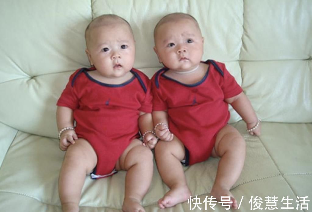 遗传物质|最好认的双胞胎走红,发量一个随妈一个随爸,网友:妈妈真偏心