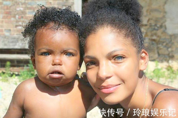 脚趾|19个“被上帝挑选过”的特殊基因人类,怎么梳都不整齐的头发