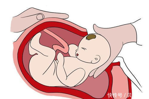 产妇|贝安健康:出现哪些情况需要剖腹?