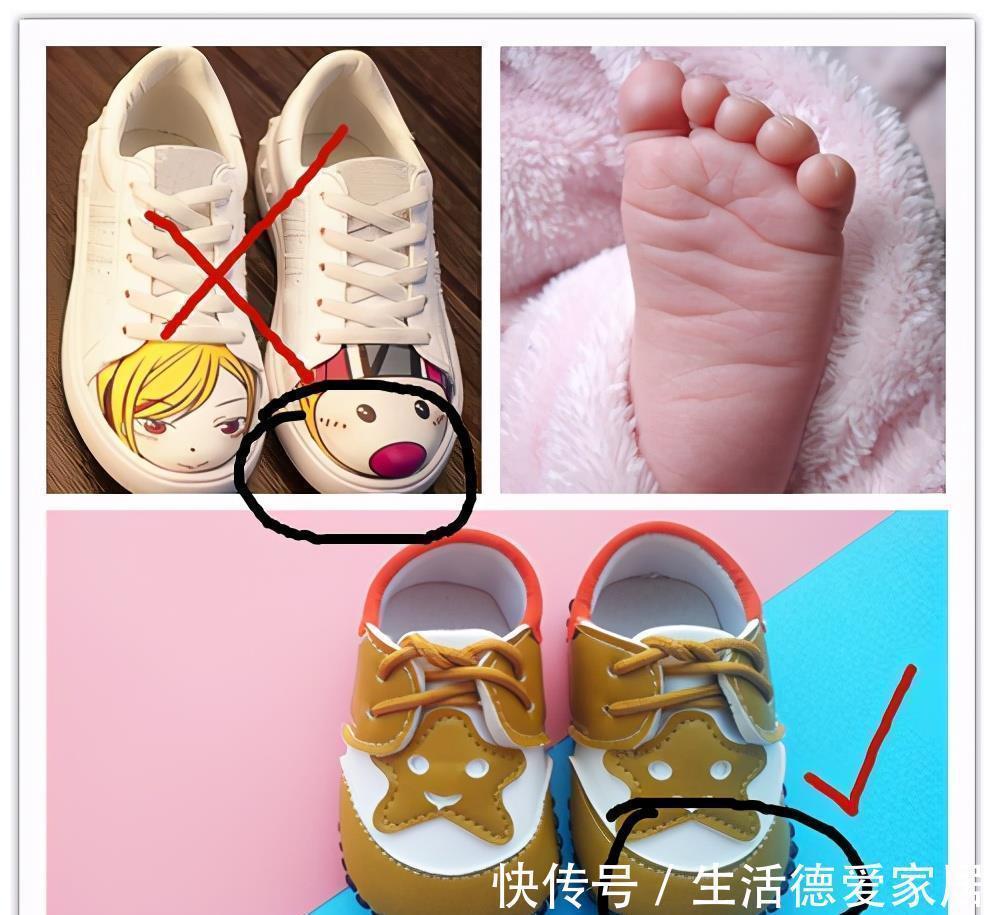 鞋头|小鞋子,大学问,如何给宝宝挑选一双合适的鞋子?