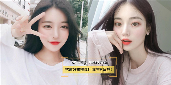 10年痘痘肌肤 良心告诉大家4款真正有效的祛痘产品 只为大家更美