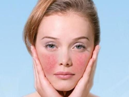 护肤攻略：敏感肌脸颊泛红怎么修复，谁说再见我们会红着脸？