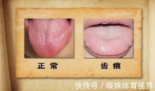 红薯|脾虚的女人老得快！常吃这3物，养好脾胃，告别黄脸婆