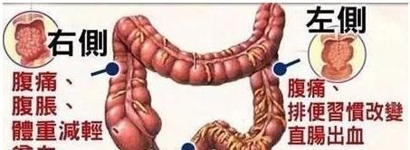 正常人一天应该排几次便若在此次数内,恭喜,肠道很健康