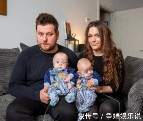双胞胎|世界最小的双胞胎男孩,怀孕23周出生,只有手掌大小却奇迹存活