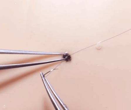 手术|给火龙果割阑尾33岁水果医生爆红吸粉90万网友看到第一个就痛了