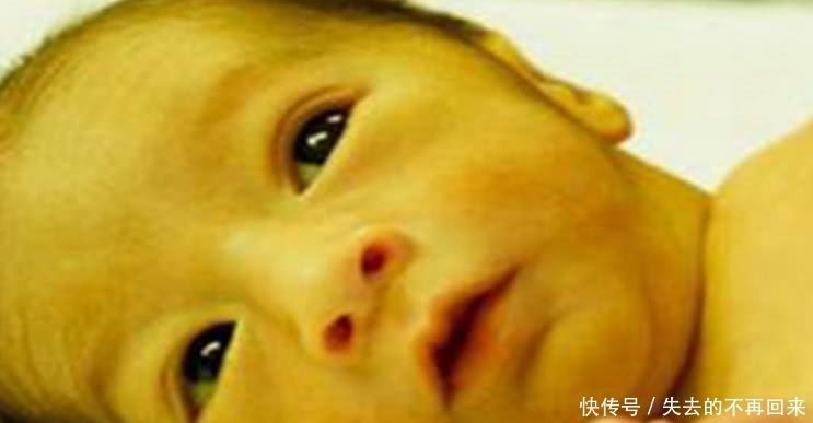 怀孕期间|儿科医生:想要孩子出生没黄疸,孕期得坚持“三不做”,别不信