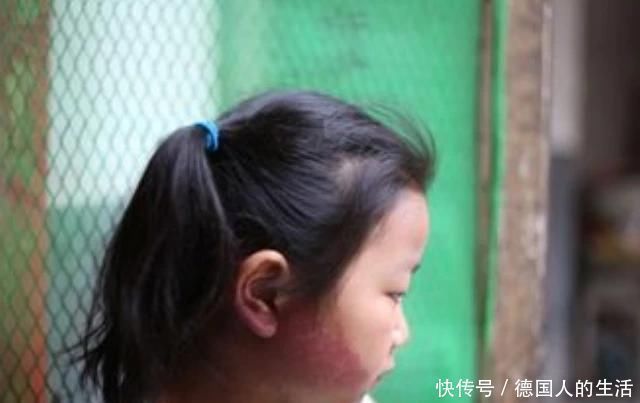 宝宝|孕妈在孕期,尽量不做4件事,避免宝宝脸上长胎记,孕妈别不在意