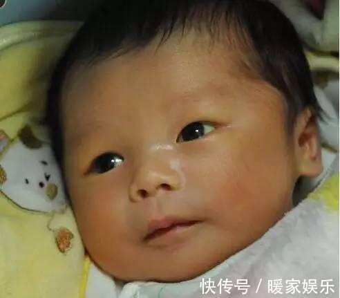 儿子|看到妈妈晒儿子的照片, 医生却发现了一个要命的地方