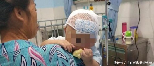 外星人|7个月宝宝头型像外星人,妈妈以为睡姿不正,医生却说必须手术