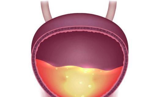 阳气不足|早晨起来这个行为,很多男性经常做!提醒:赶紧停止,伤肾又伤肝