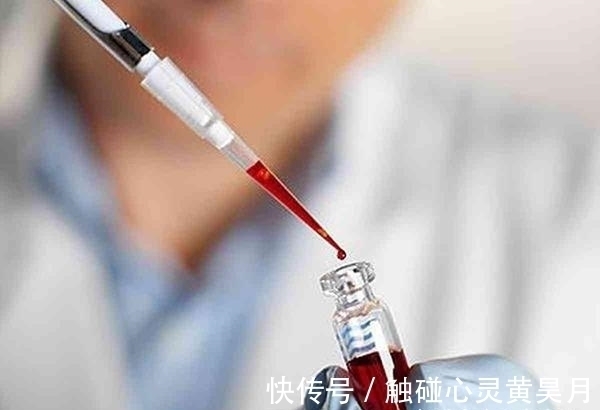 生存法则|4个血型哪个血型最好,4个血型中哪种血型最好