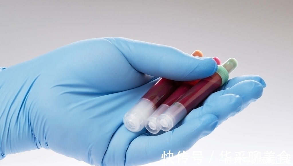 脂质|心血管主任:补充1种“酸”,血管干干净净、血脂能降下来